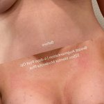 the naked breast