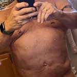 22 weeks post op vagina. Still some swelling but very happy with the new me!