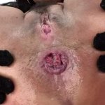 This babys ass is destroyed